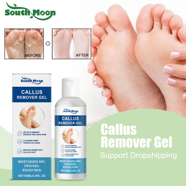 Smooth Feet Callus Remover Gel